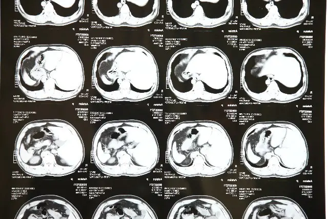 検診予約・実施・結果のお渡し